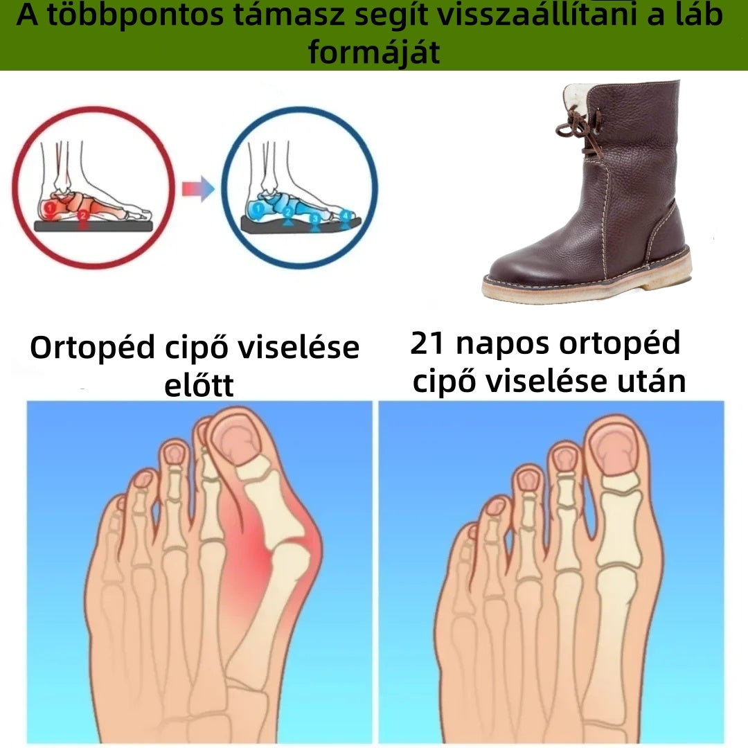 (❄️Utolsó nap, 70% kedvezmény) Ne maradj le! ⏰Kényelmes és meleg valódi gyapjú cipők, 💧vízálló és csúszásgátló, ✅lábboltozat-támasztással a lábfájdalom enyhítésére.