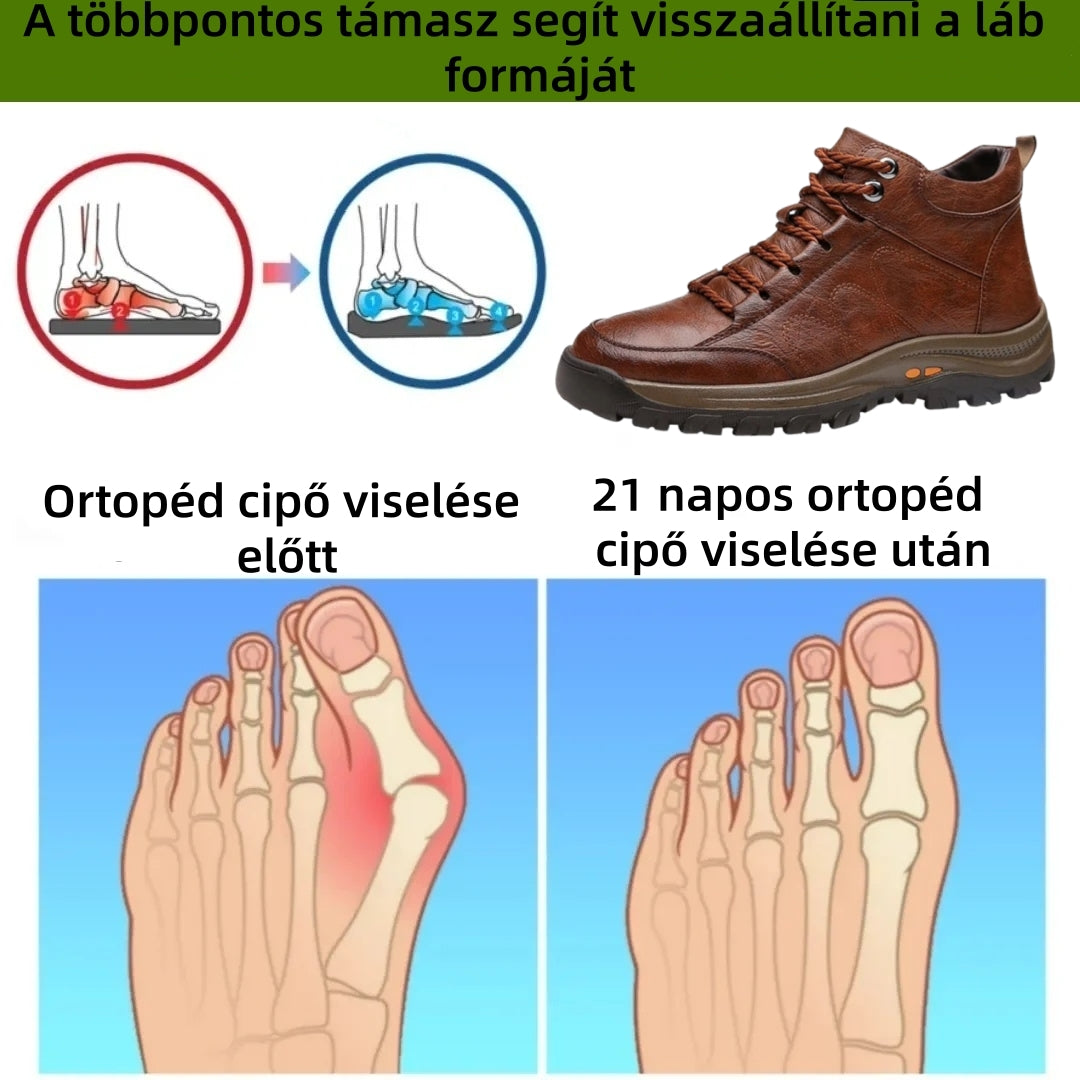 【⏰Utolsó nap, 70% kedvezmény! Ne maradj le!】Ergonómiailag tervezett ütéscsillapító ortopédiai cipők, ✅️bőr ortopédiai cipők kifejezetten európai férfiak számára.