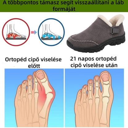 【⏰ Utolsó nap: 70% kedvezmény! Ne maradj le róla!】 Ergonomikus kialakítású és ütéselnyelő technológiával ellátott ortopéd cipők – ✅️ kifejezetten európai nők számára tervezve.