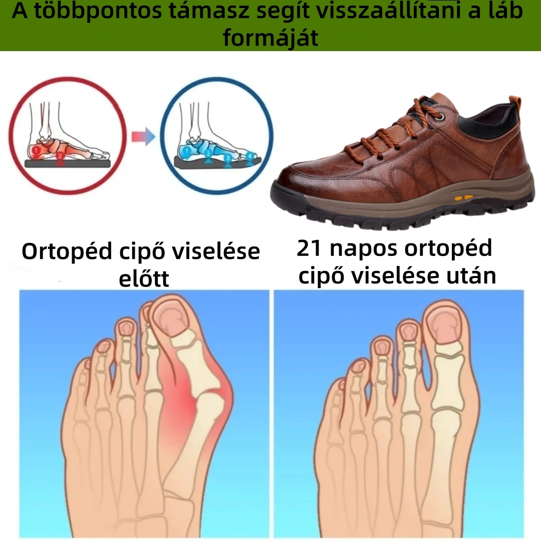 【⏰Utolsó nap, 70% kedvezmény! Ne maradj le!】Ergonómiailag tervezett ütéscsillapító ortopédiai cipők, ✅️bőr ortopédiai cipők kifejezetten európai férfiak számára.