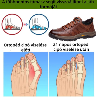 【⏰Utolsó nap, 70% kedvezmény! Ne maradj le!】Ergonómiailag tervezett ütéscsillapító ortopédiai cipők, ✅️bőr ortopédiai cipők kifejezetten európai férfiak számára.