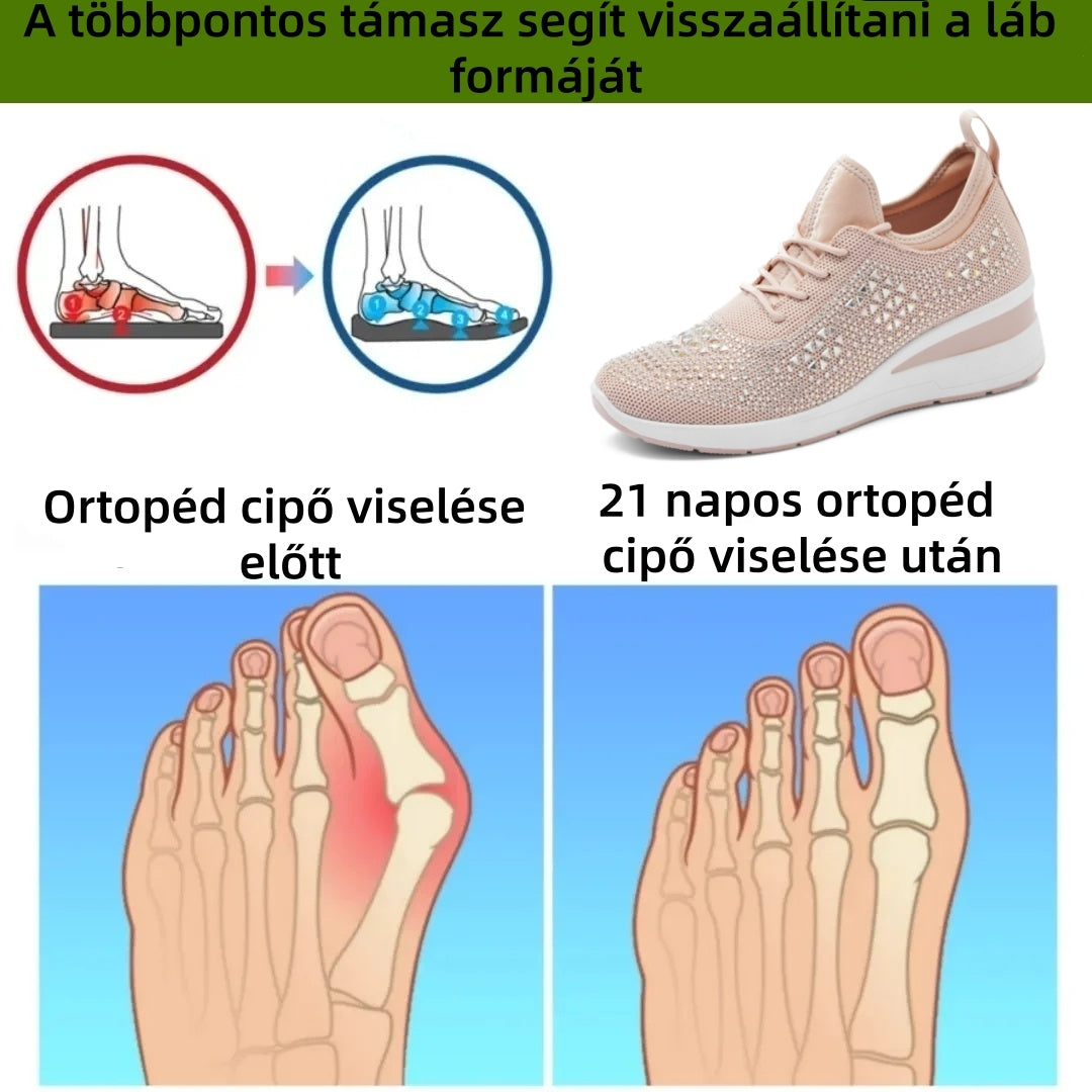 【⏰Utolsó nap, 70% kedvezmény! Ne maradj le!】Ergonómiailag tervezett ortopéd cipők ütéscsillapítással, ✅️Egészséges ortopéd cipők kifejezetten európai nők számára.