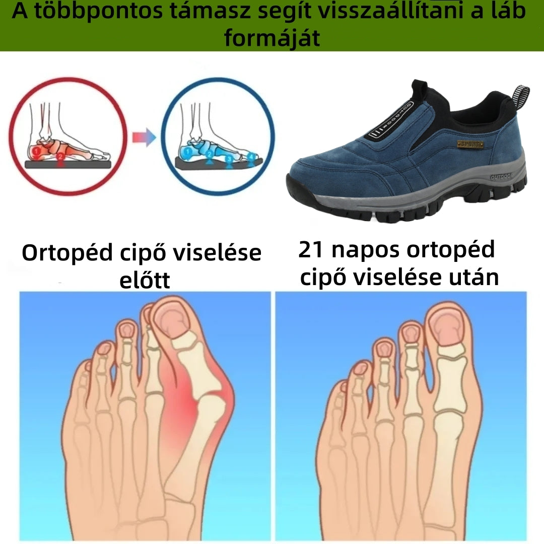 【⏰Utolsó nap, 70% kedvezmény! Ne maradj le!】Ergonómiailag tervezett ütéscsillapító ortopédiai cipők, ✅️bőr ortopédiai cipők kifejezetten európai férfiak számára.